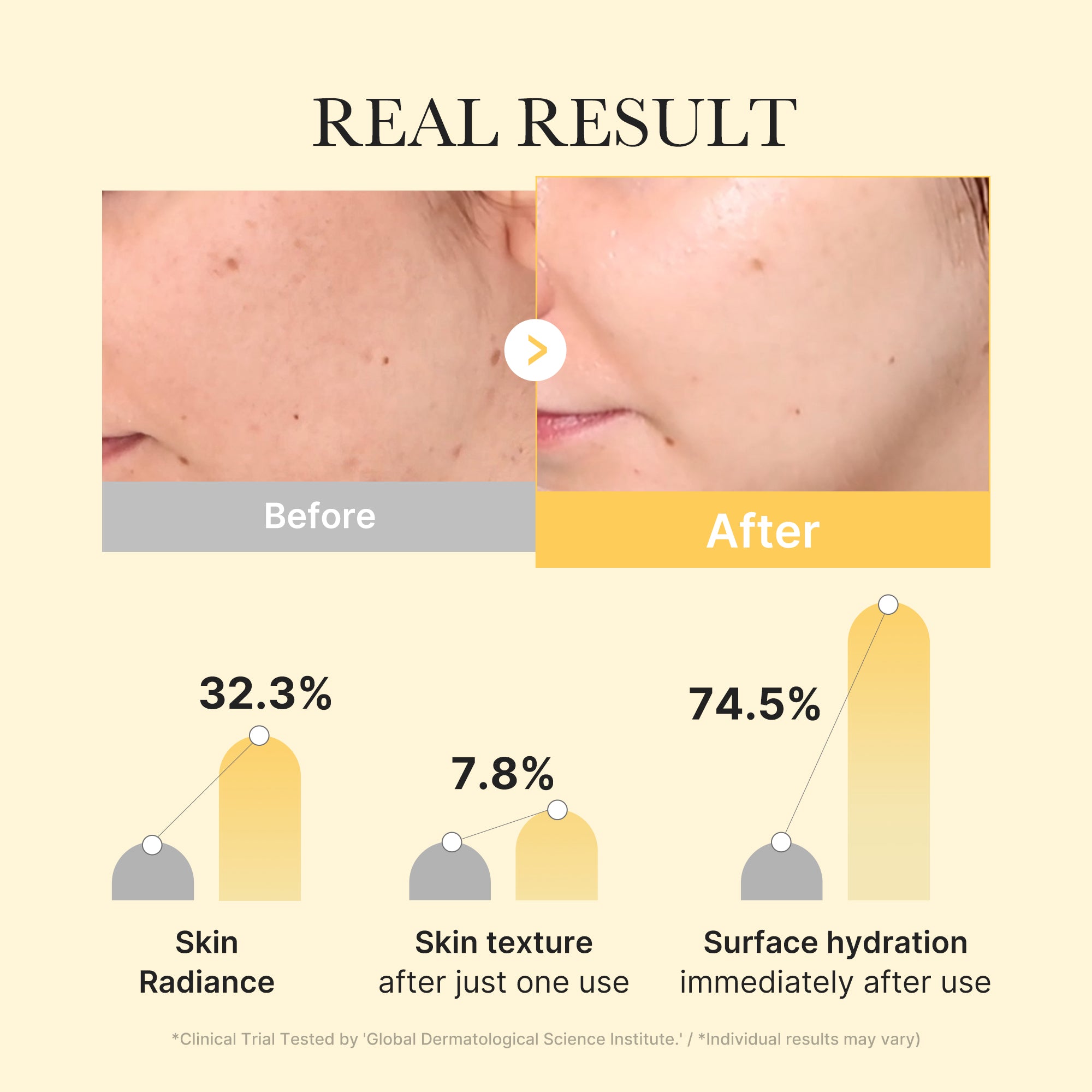 Kojic Acid Turmeric Gold Jelly Gel Mask